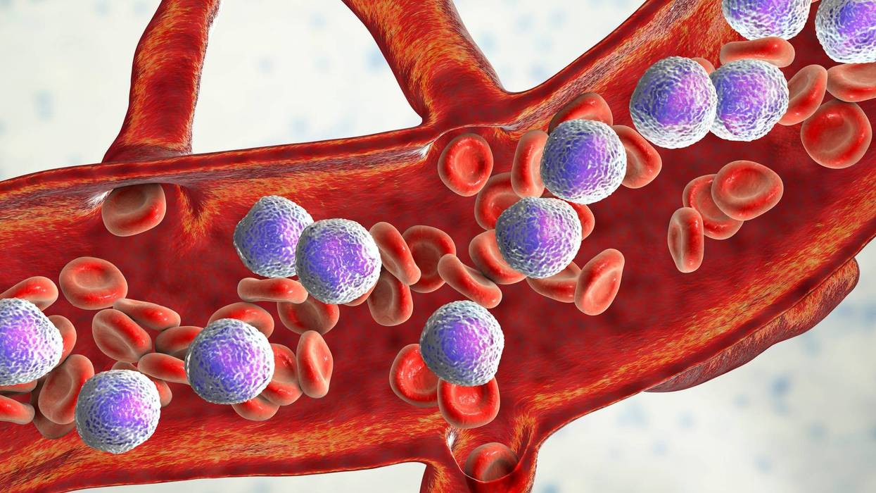 3D illustration showing abundant acute lymphoblastic leukemia in a blood vessel.