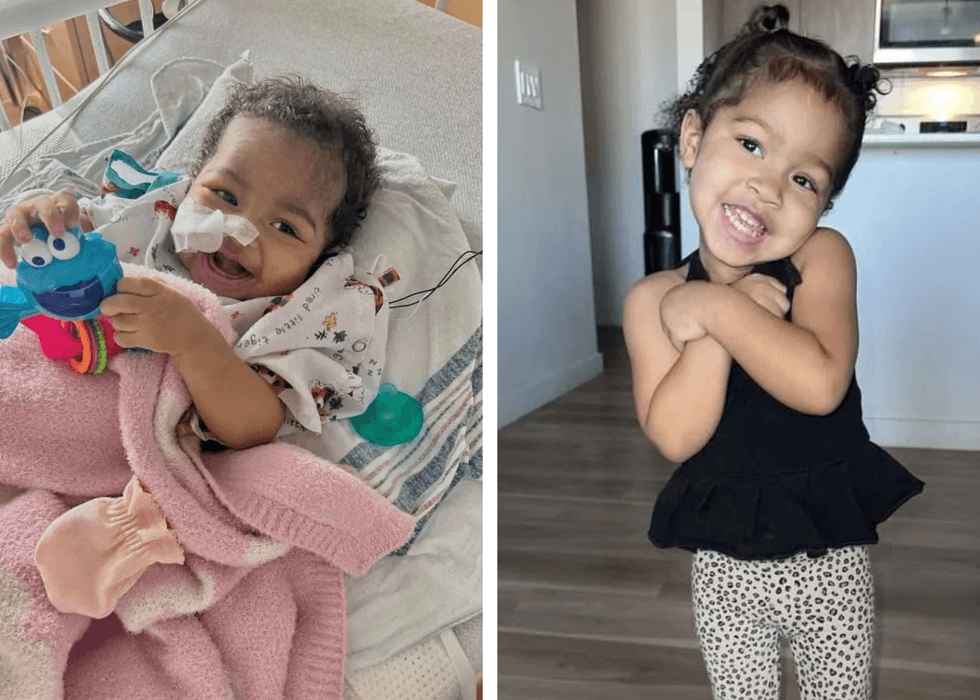 9-month old girl Selena that received the donated liver portion from Mark