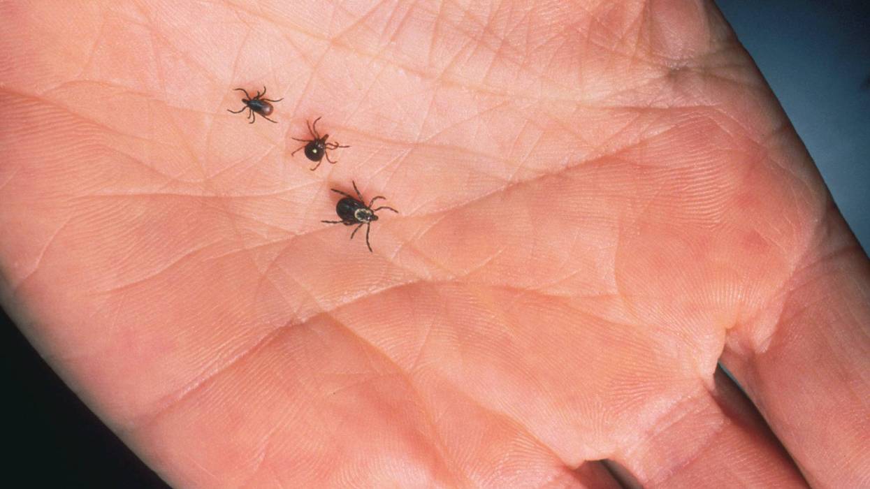 A close-up of an adult female deer tick, dog tick, and a lone star tick are shown June 15, 2001, on the palm of a hand.