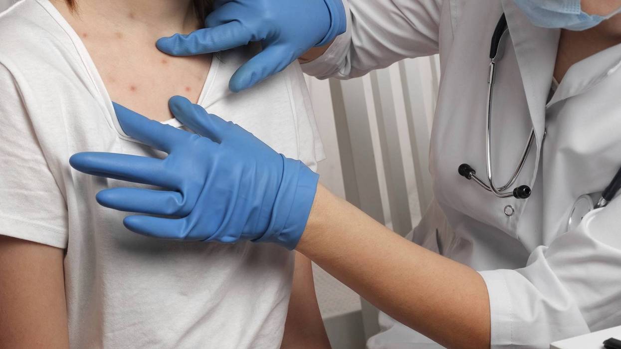 A doctor examines a patient with measles.
