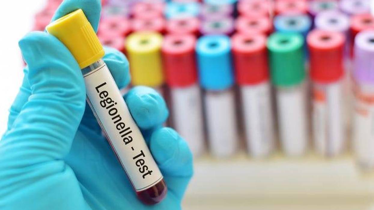 A gloved hand holds a vial of blood that says "legionella"