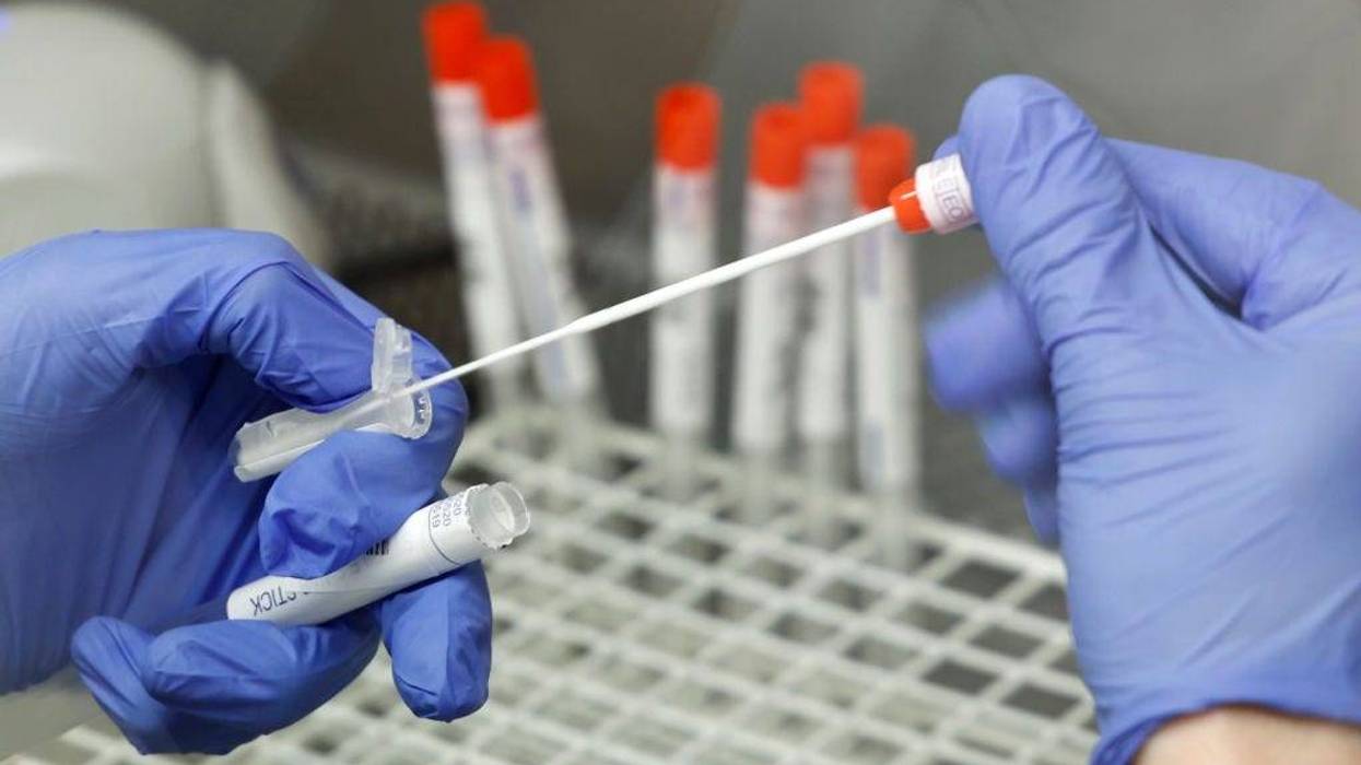 A lab technician is working on smears for PCR tests for Covid-19 during the coronavirus pandemic on February 22, 2021 in the Labor Dr. Krause & Kollegen laboratory in Kiel, Germany.