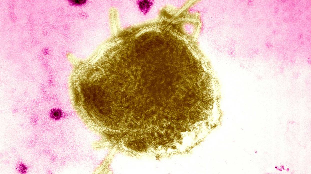 A measles virus is seen under a microscope