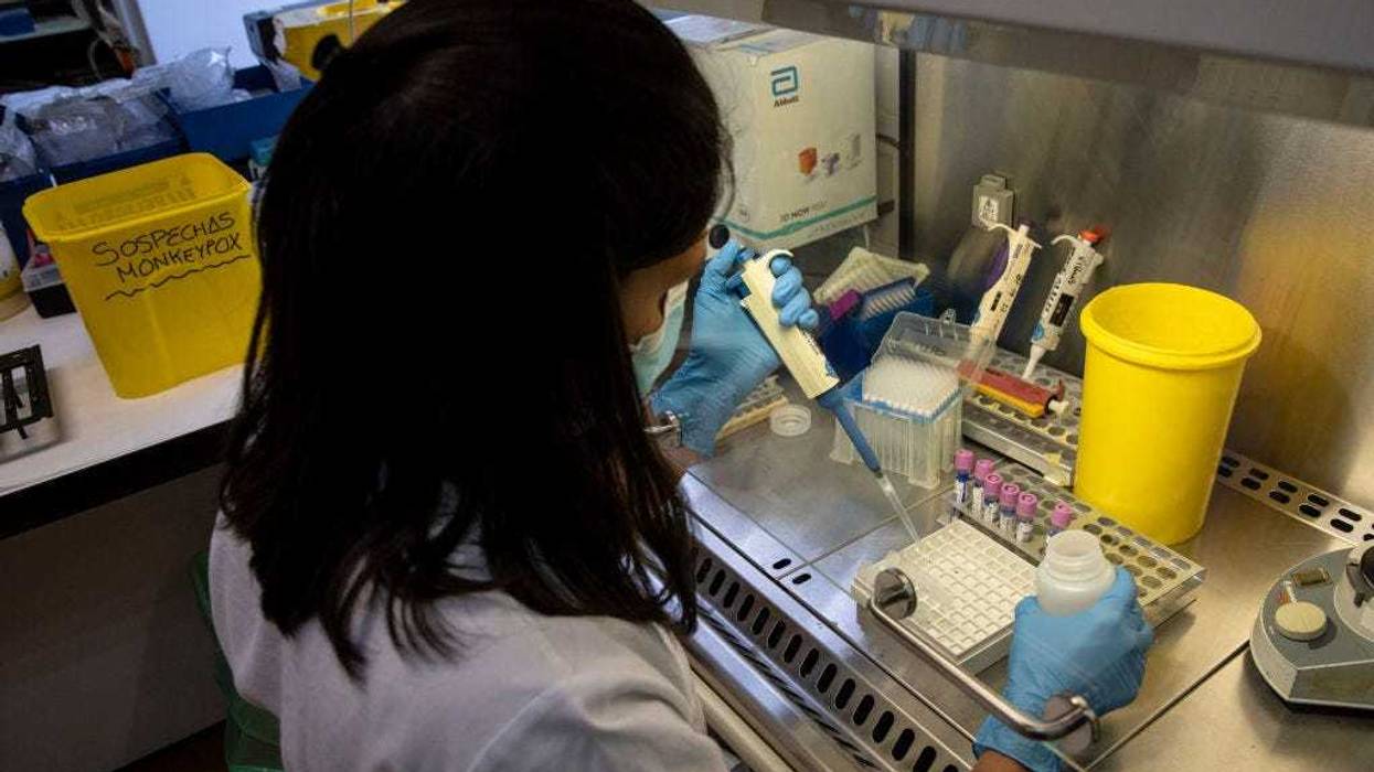 A medical laboratory technician inactivates suspected monkeypox samples to be tested at the microbiology laboratory of La Paz Hospital on June 06, 2022 in Madrid, Spain. Europe is at the centre of the monkeypox virus outbreak, the World Health Organisation reported 780 confirmed cases with Britain, Spain and Portugal reporting the largest numbers of patients. (Photo by Pablo Blazquez Dominguez/Getty Images)