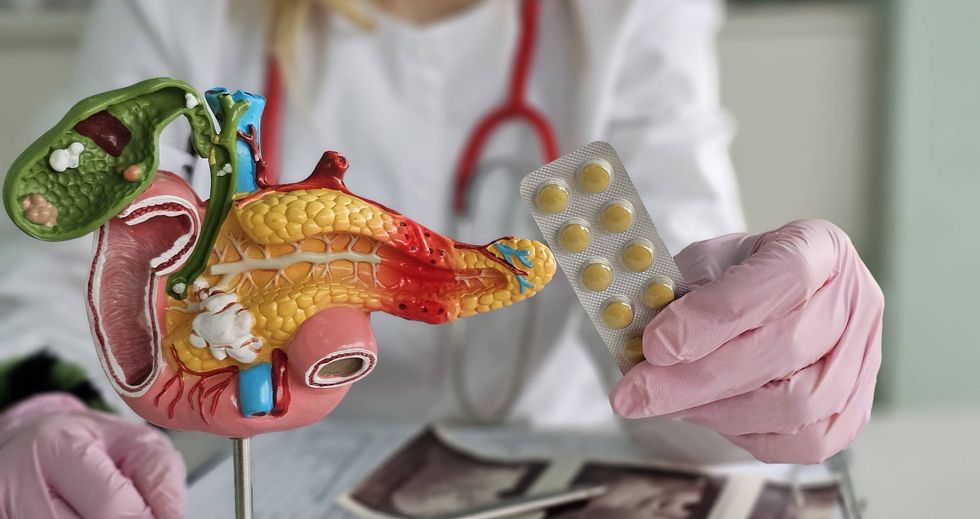 A new drug to treat pancreatic cancer is a 