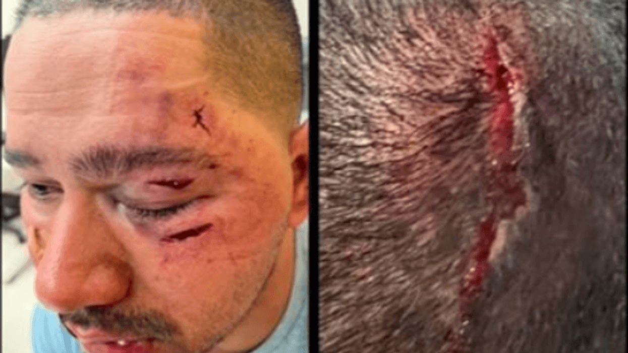 A photo of the officer after the attack published by Police Benevolent Association 105 on Twitter.
