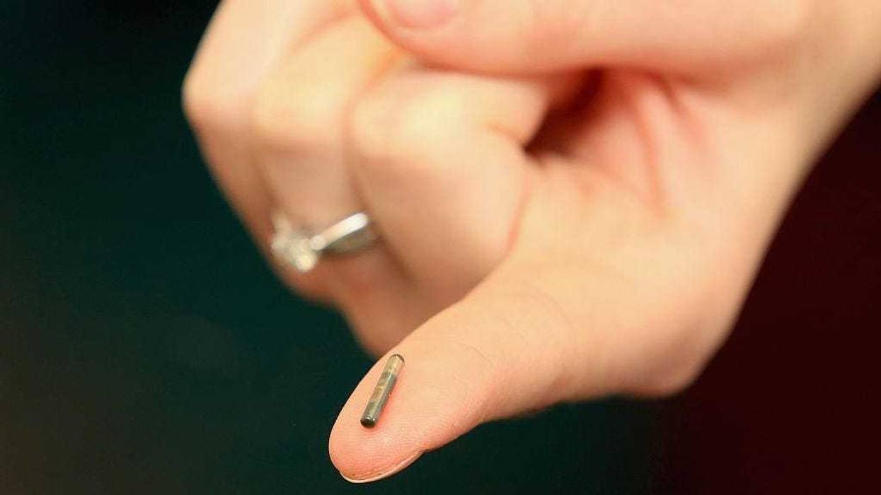 A veterinary nurse holds a dog micro-chip at the PDSA hospital on April 4, 2016 in Wolverhampton, England. From 6th April 2016 it will become law, in the UK, that all dogs should be microchipped and recorded in the National Canine Database.