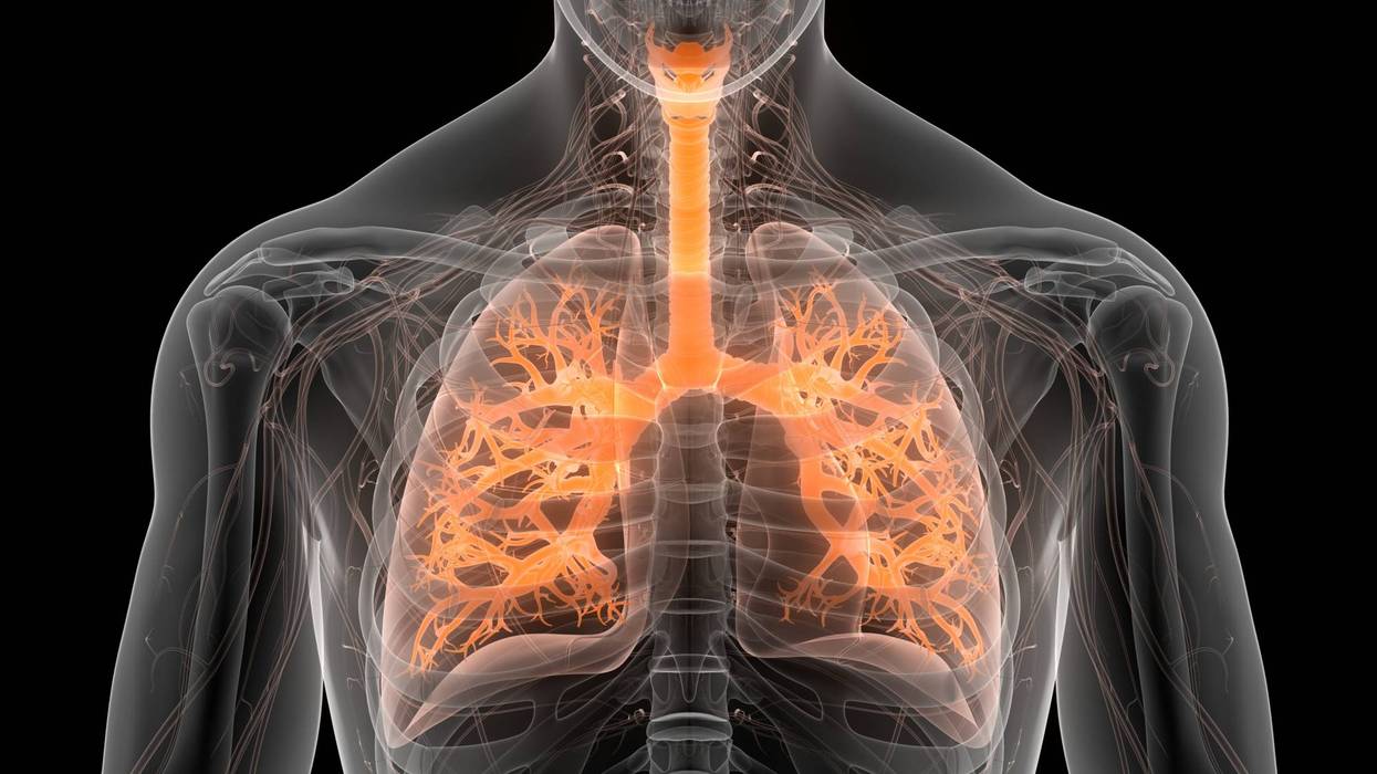 Active tuberculosis cases reported in Oxnard, Palm Springs