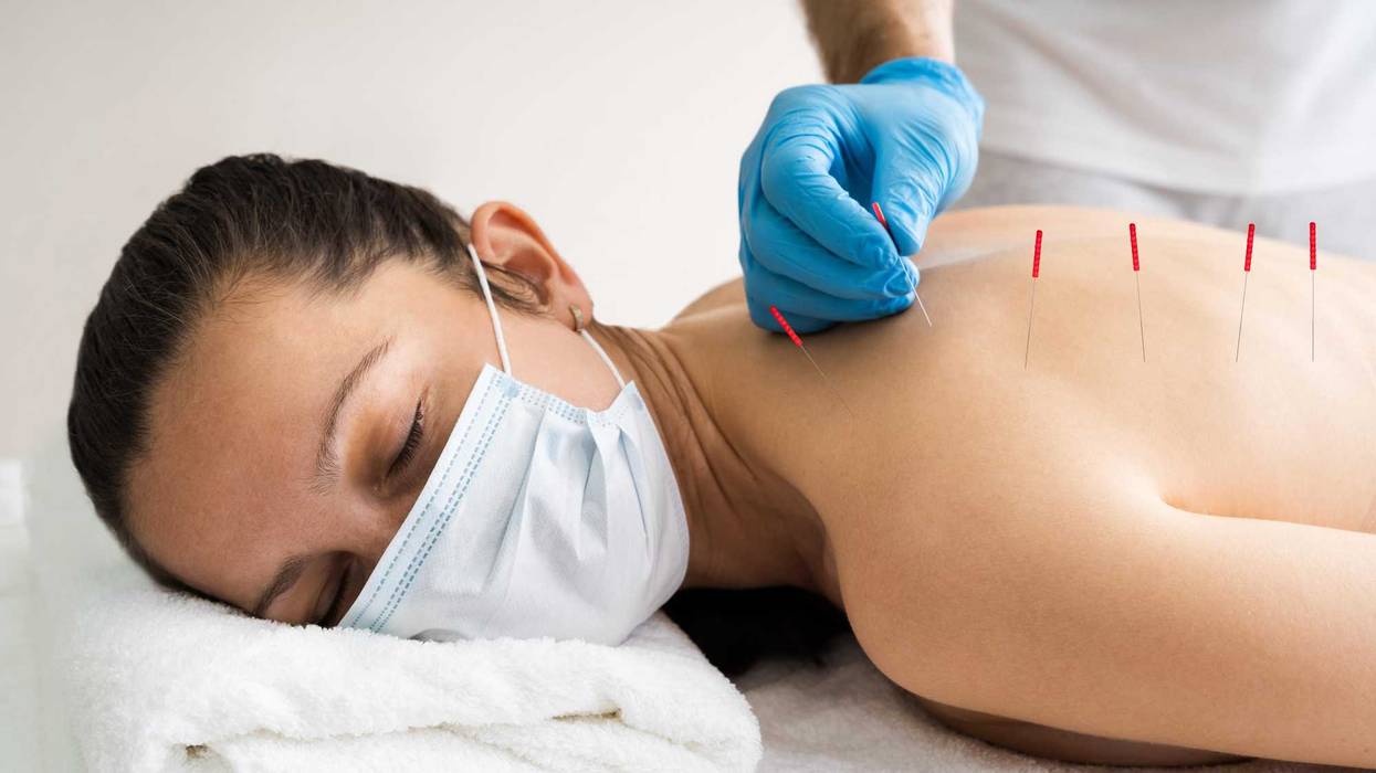 Acupuncture