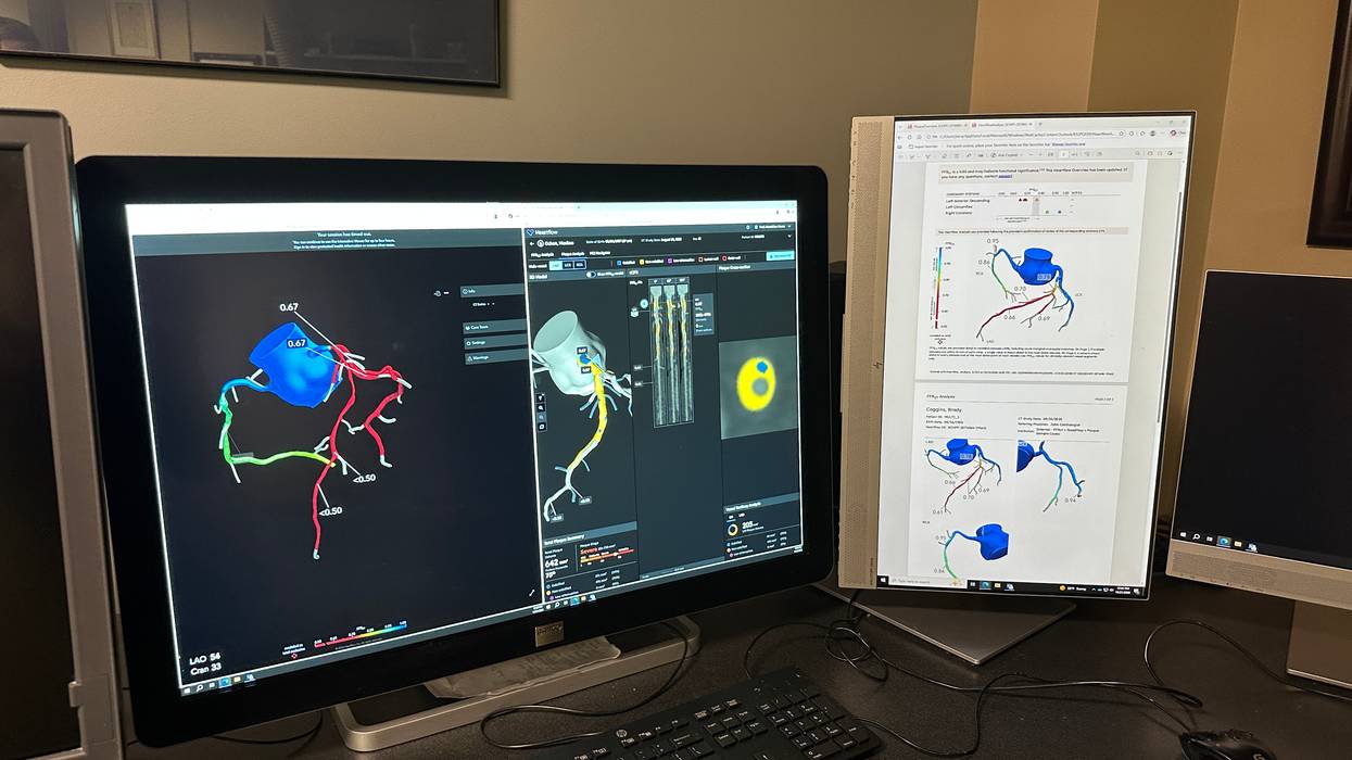 AI assisting heart patients