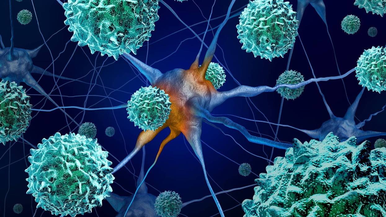An alert has gone out from the Centers for Disease Control and Prevention for physicians to be looking for symptoms of a rare but serious disease called Acute Flaccid Myelitis or AFM.