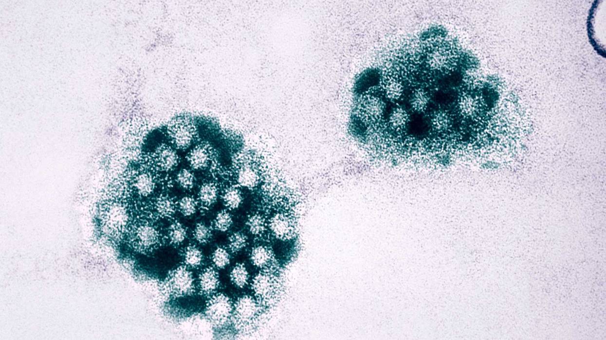 An electron micrograph of the norovirus, with 27 32Nm sized viral particles.