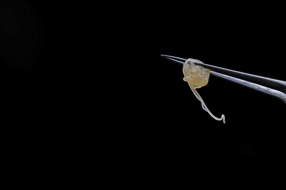 Anisakis. The tip of a surgical forceps holding parasitic fish worms.