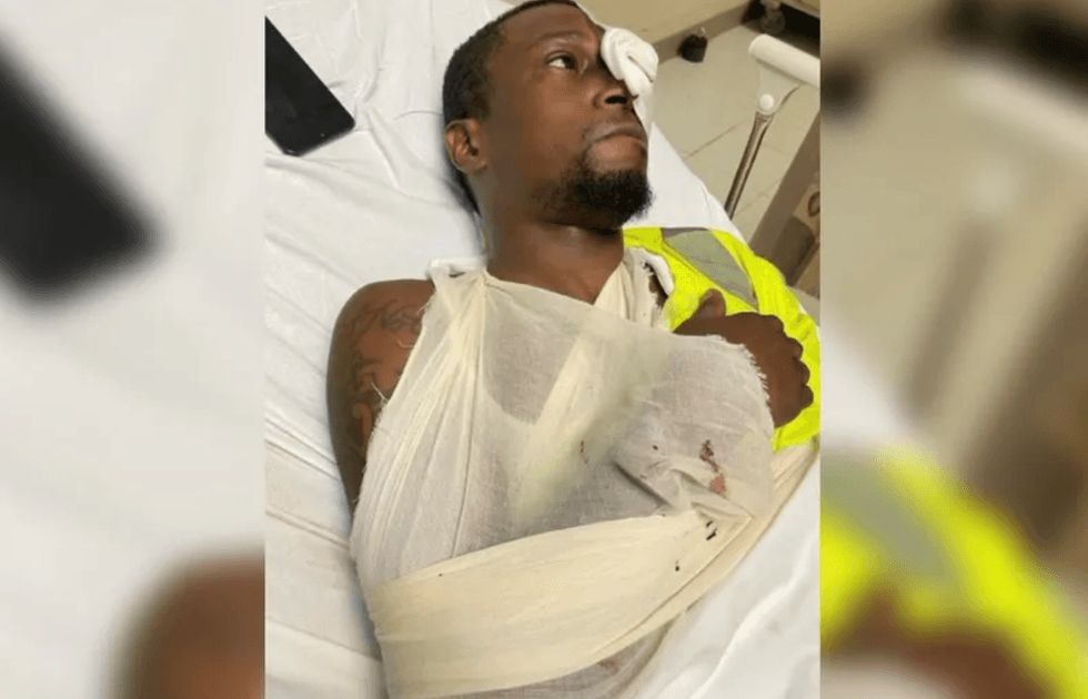 Anthony Nelson after his brutal beating.