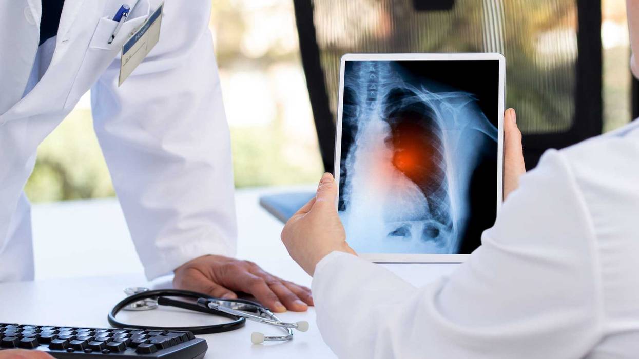 As health experts gain a further understanding about long COVID-19, some are warning that the condition is more common than we previously thought.