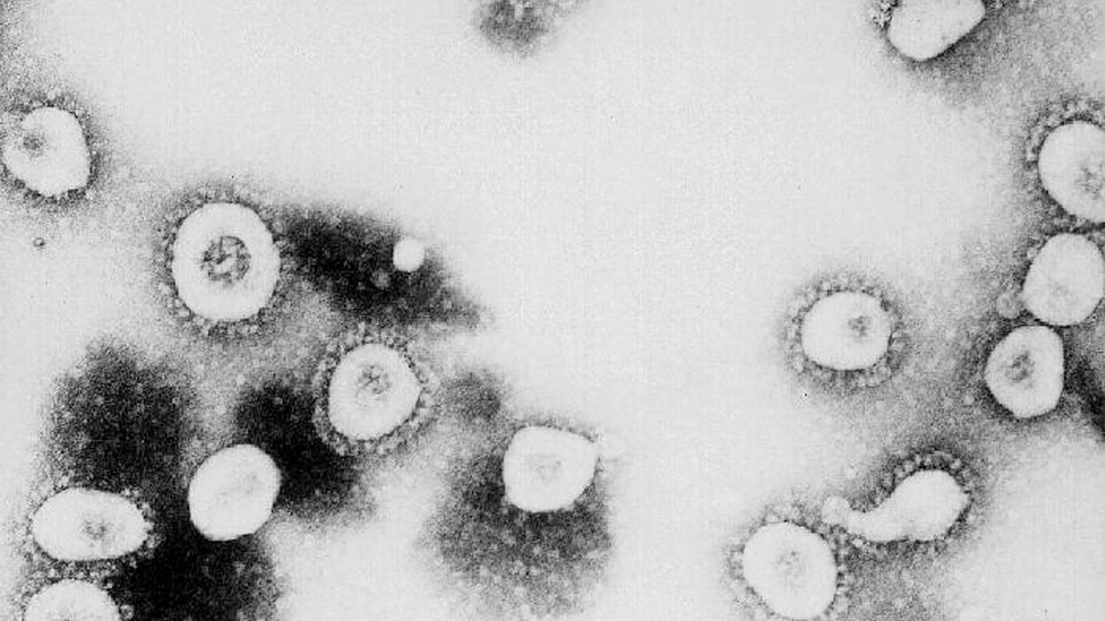 ATLANTA, GA - UNDATED: This undated handout photo from the Centers for Disease Control and Prevention (CDC) shows a microscopic view of the Coronavirus at the CDC in Atlanta, Georgia.