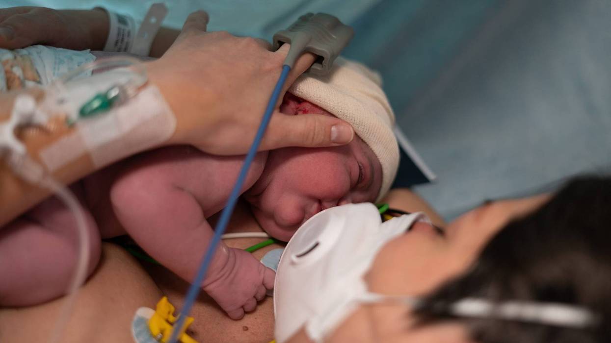 Baby born by caesarean section and mother