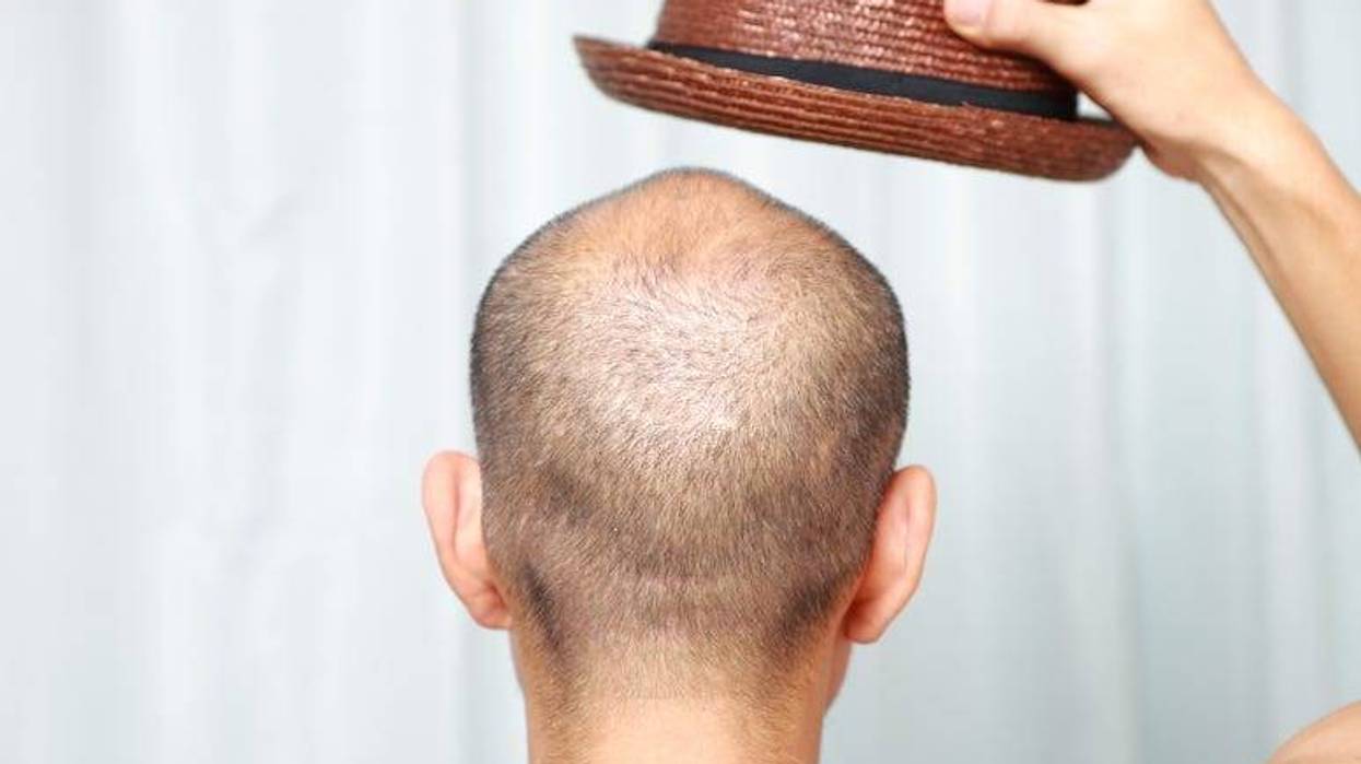 Bald Man, Hat