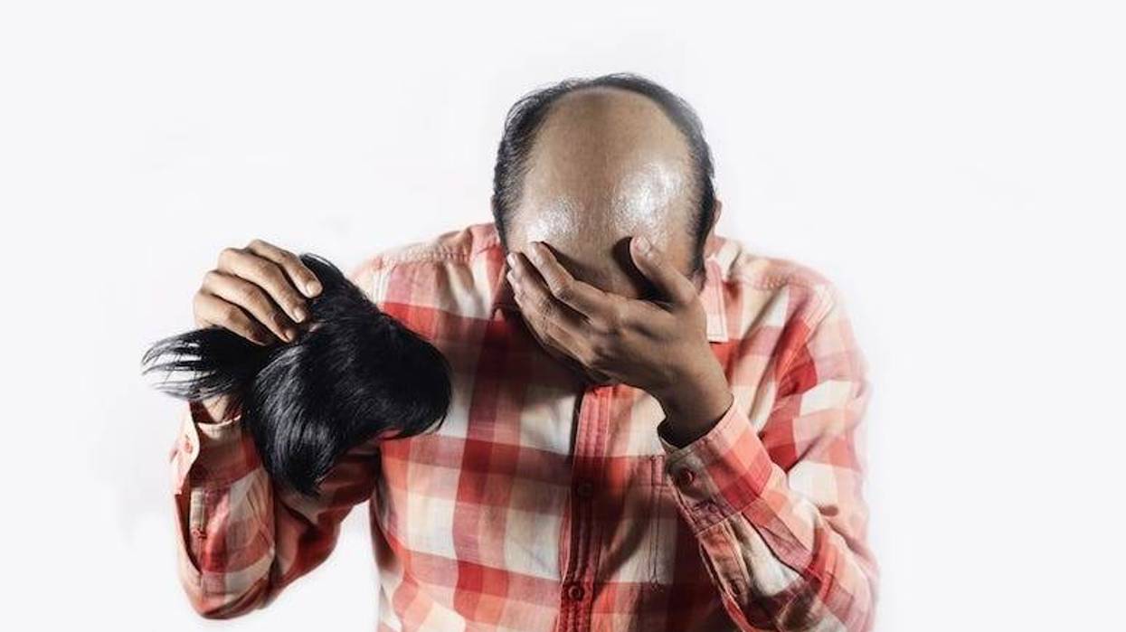 Bald, Man, Wig, Toupee, Shame