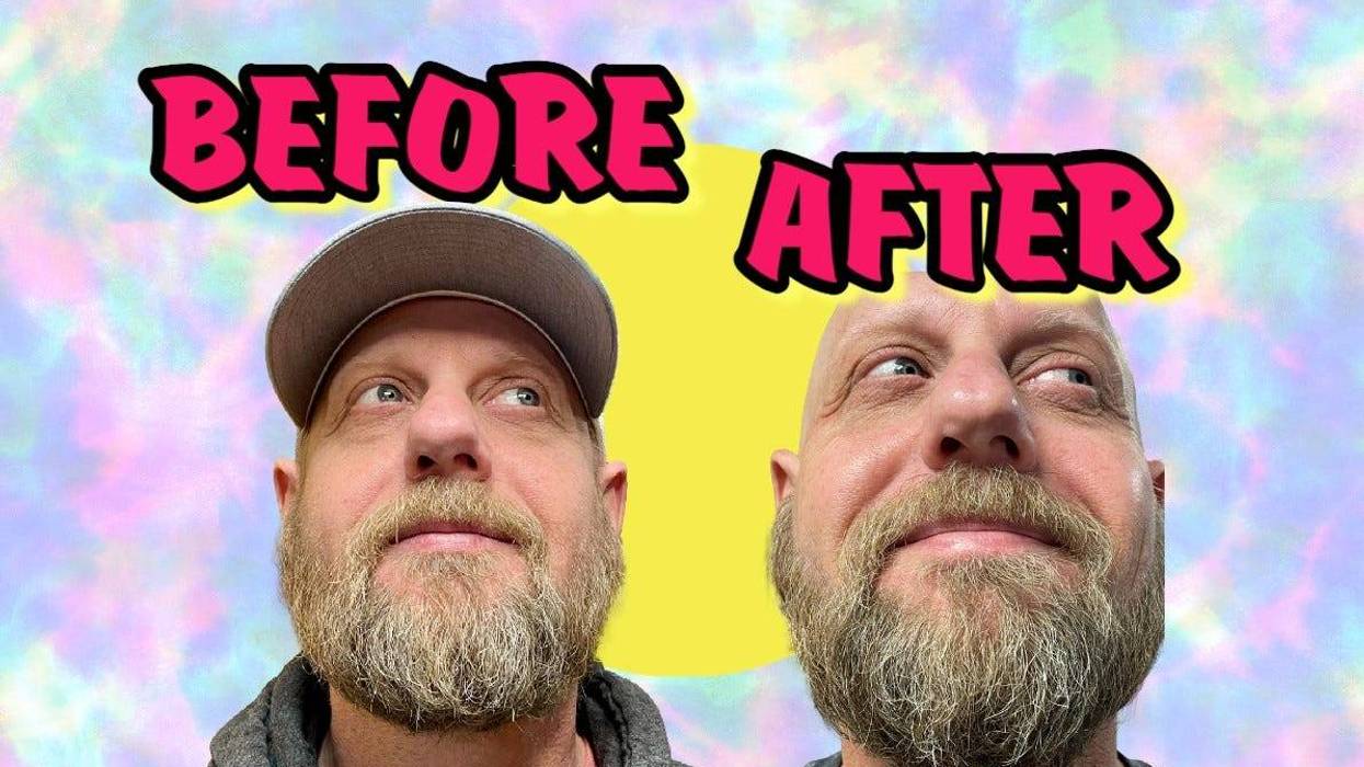 before after