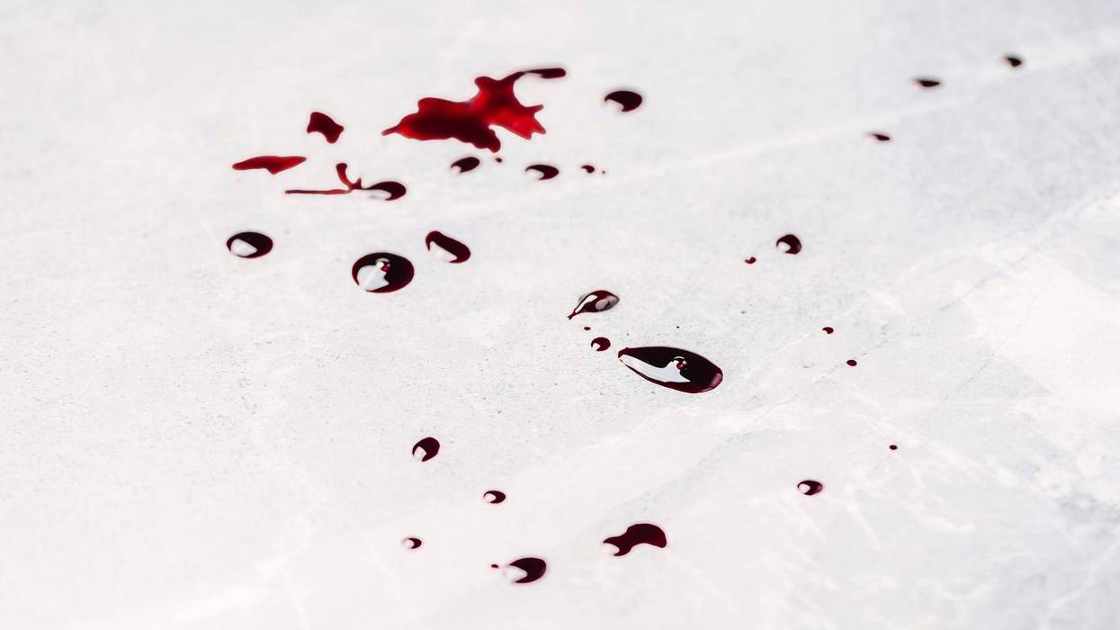 Blood droplets