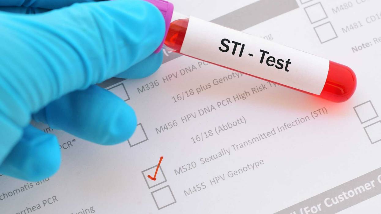Blood sample for sexually transmitted infection (STI) test.