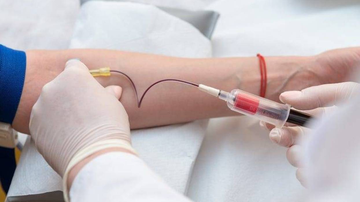 blood sampling