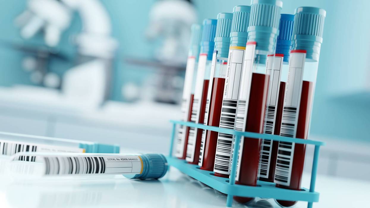 Blood Test Results In A Medical Lab