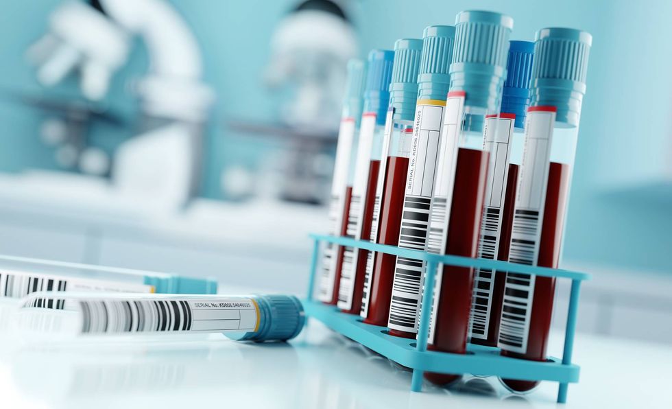 Lead testing coming to Chicago neighborhoods