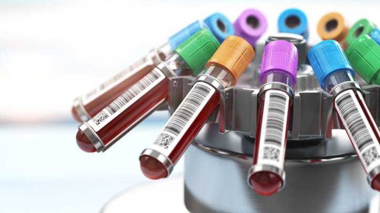 Blood test tubes in centrifuge