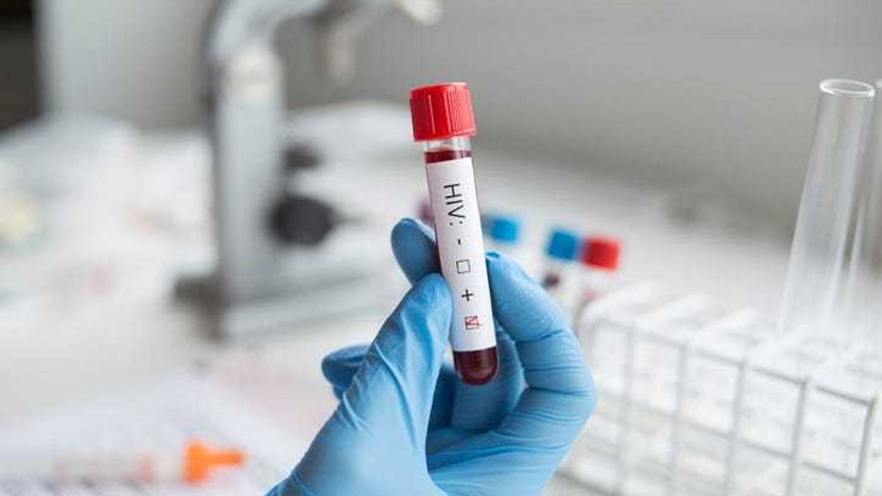 Blood that has tested positive for HIV.