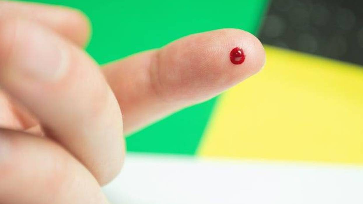 Bloody Finger