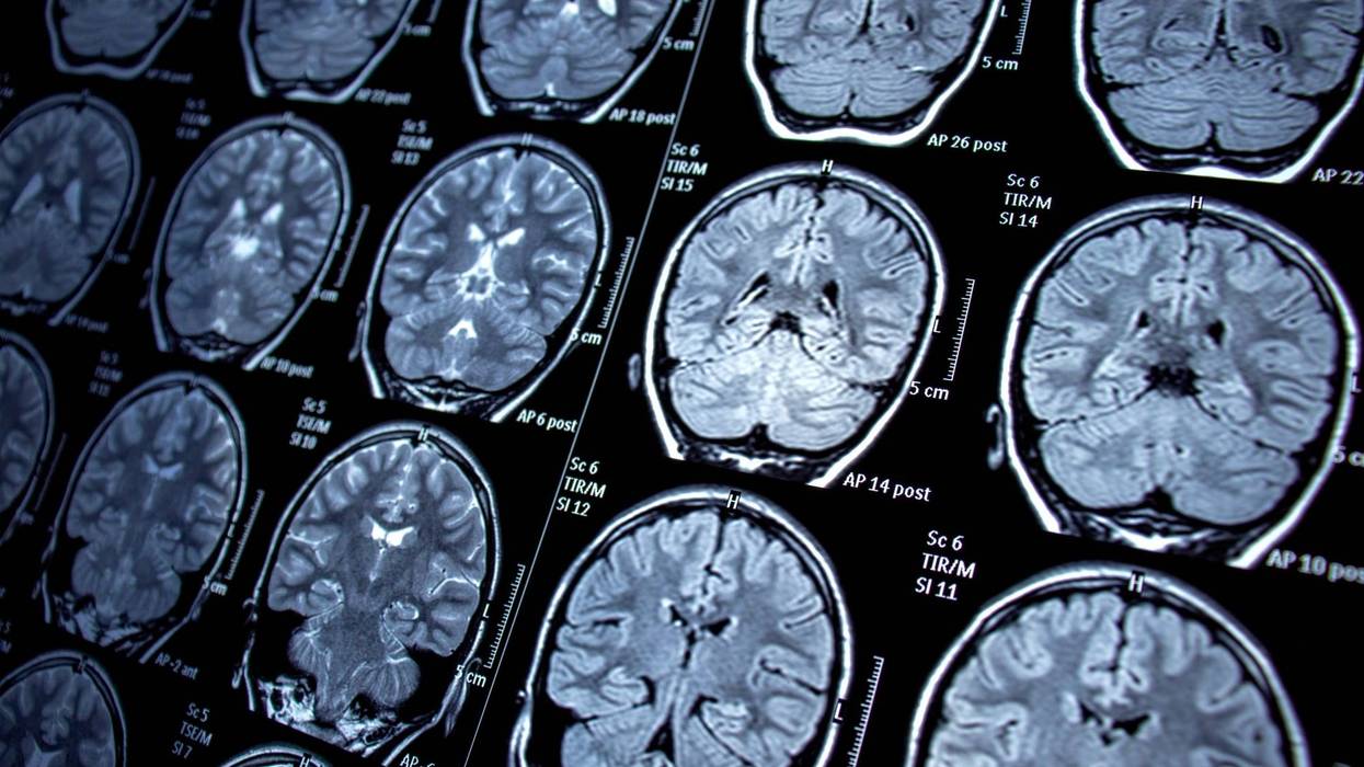 Brain Scan