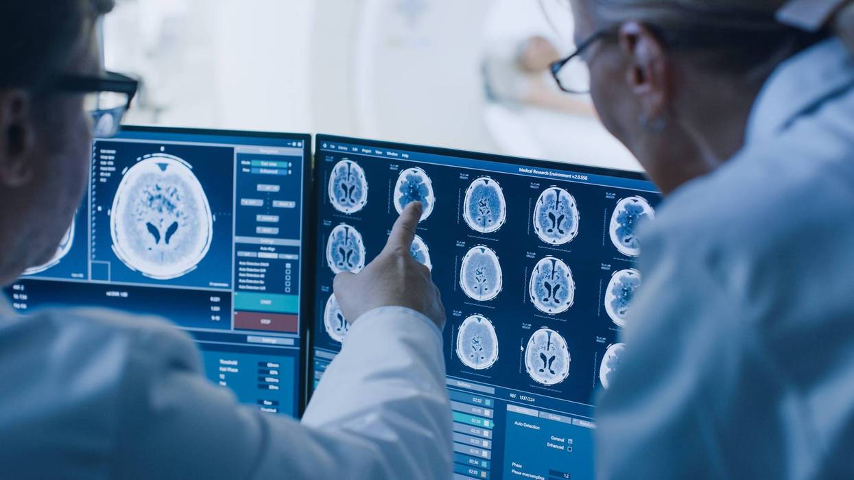 brain scan