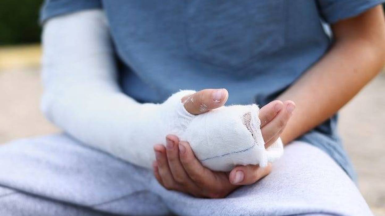 Broken arm
