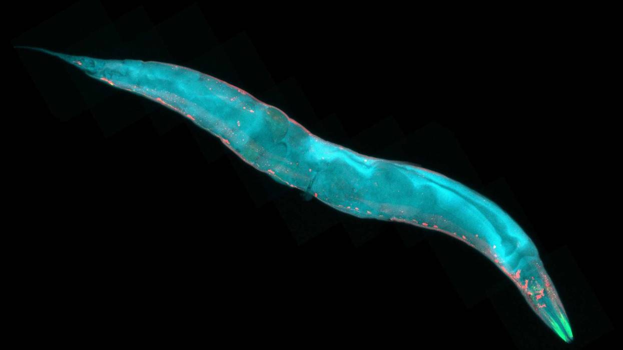 Caenorhabditis elegans, a free-living transparent nematode (roundworm), about 1 mm in length. Fluorescence micrograph.