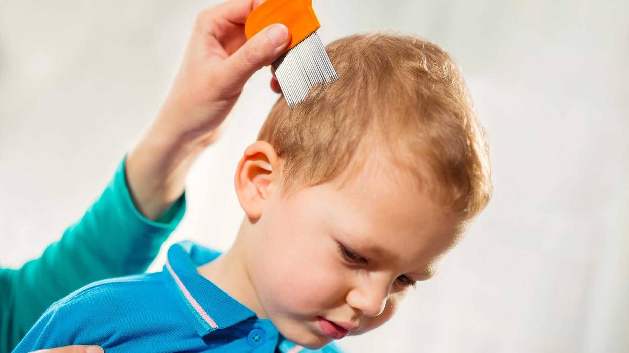 Child being checked for lice stock photo.