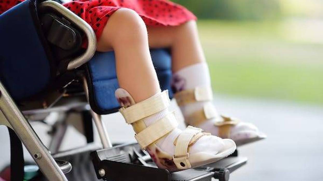 Child with cerebral palsy sitting in wheelchair