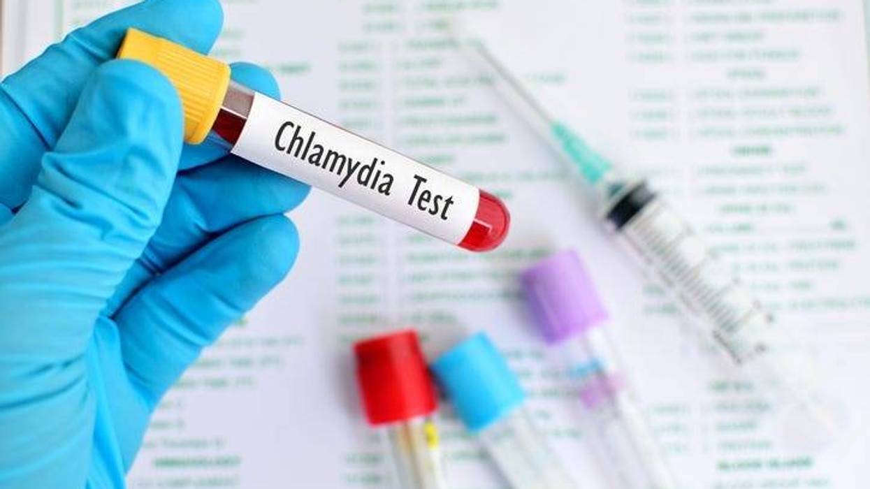 Chlamydia test.