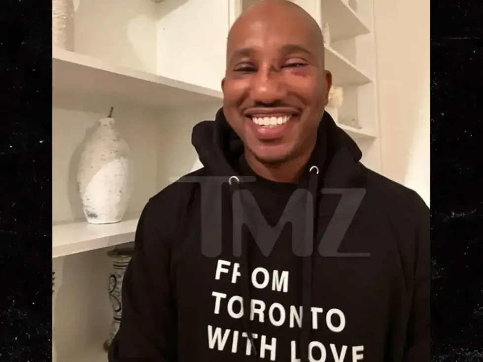 Chris Redd in a photo obtained by TMZ after he was assaulted in NYC.