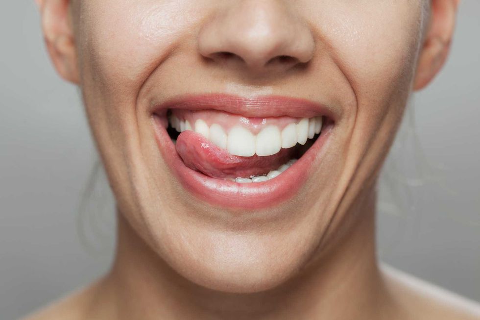 Clean teeth may mean no more migraines