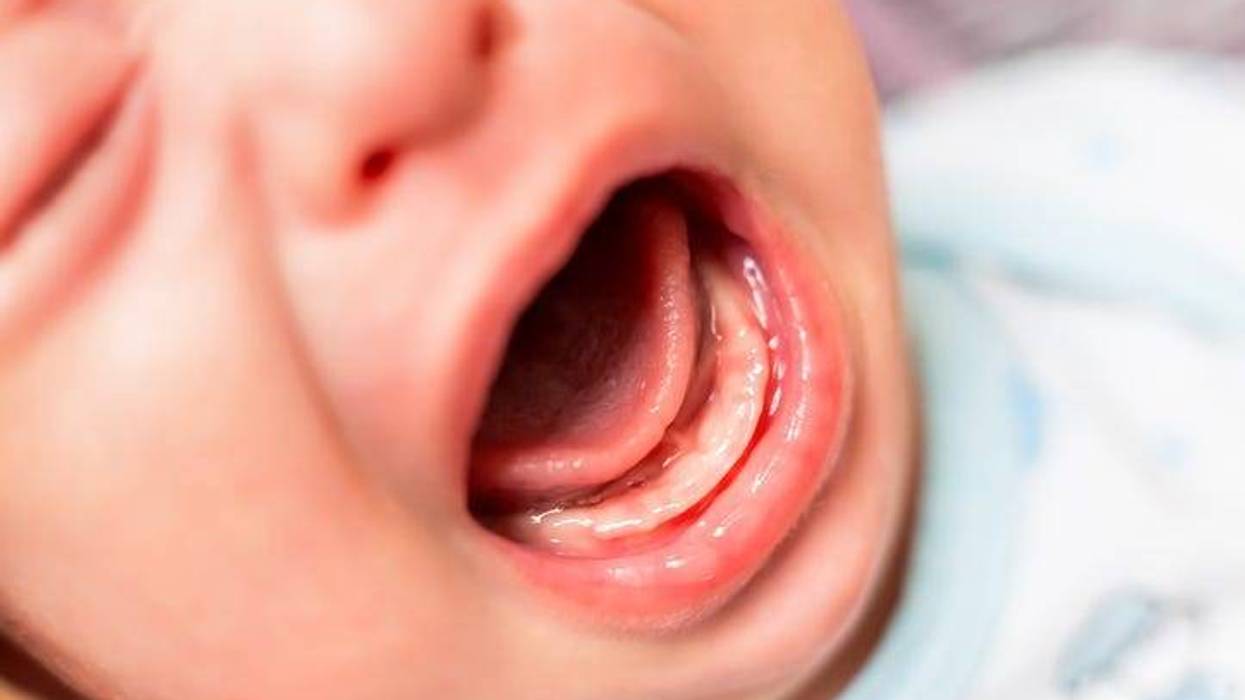 Close up photo of crying 3 months old baby mouth. Bare gums without teeth.