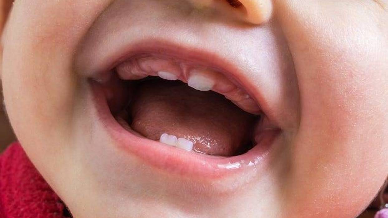 Closeup view on open mouth of baby. First teeth growing.