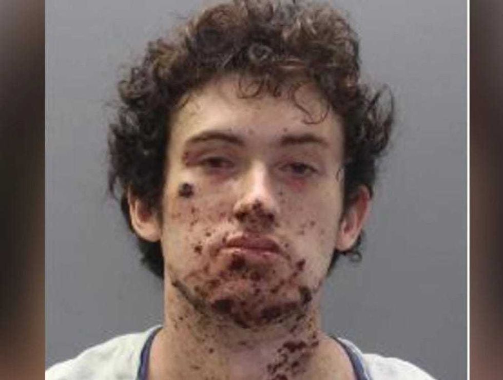 Virginia Man Blows Off Hand