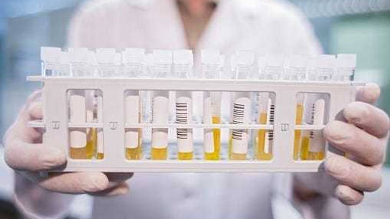 collecting convalescent plasma from recovered Covid patients