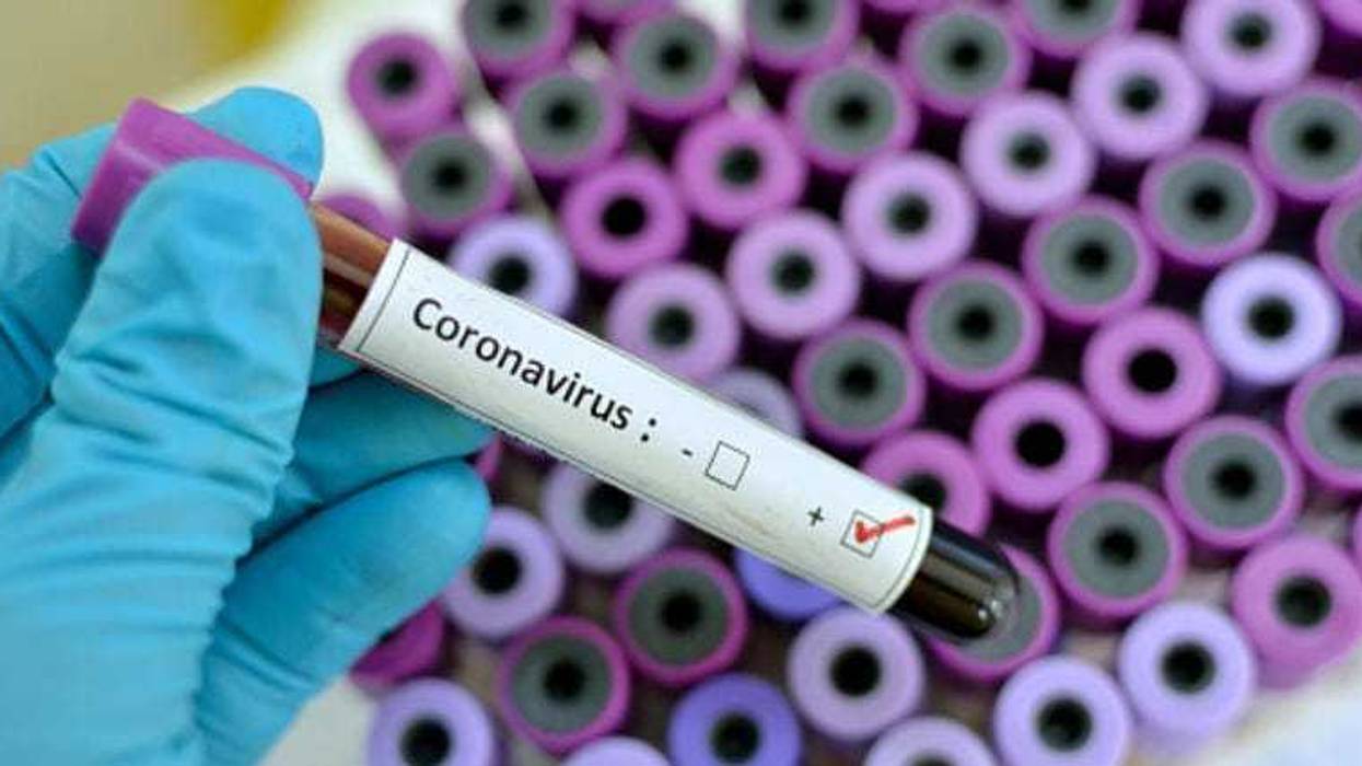 Coroanvirus test