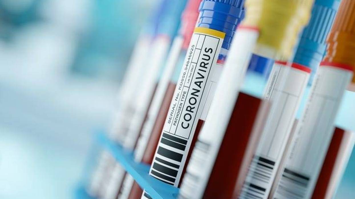 Coronavirus blood samples