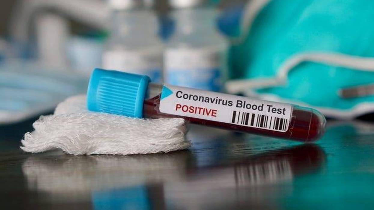 coronavirus blood test