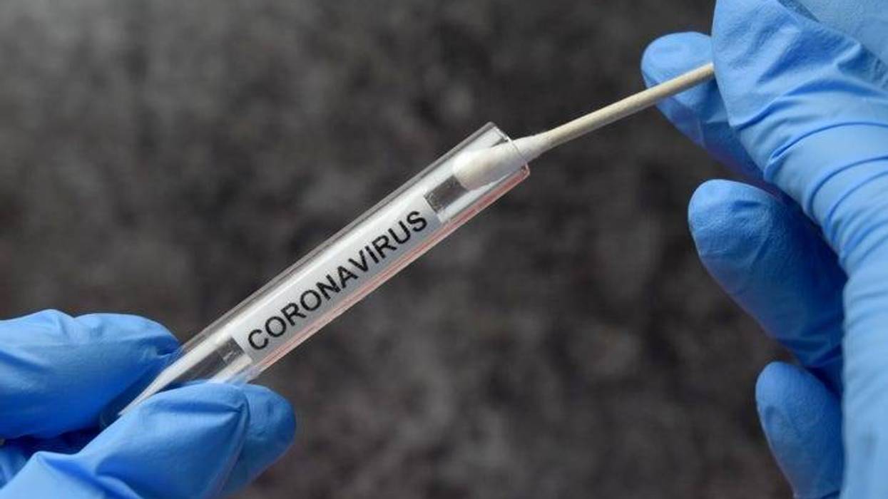 Coronavirus Test Tube - File Photo