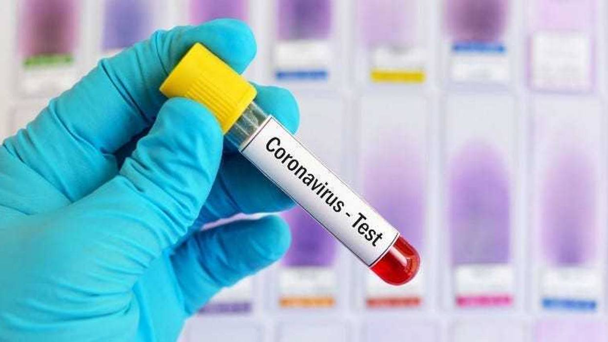 coronavirus test
